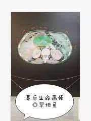 放療日常 放療日常